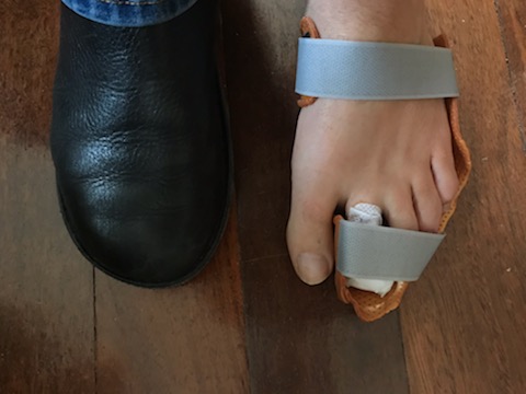 toe-splint-2.jpg