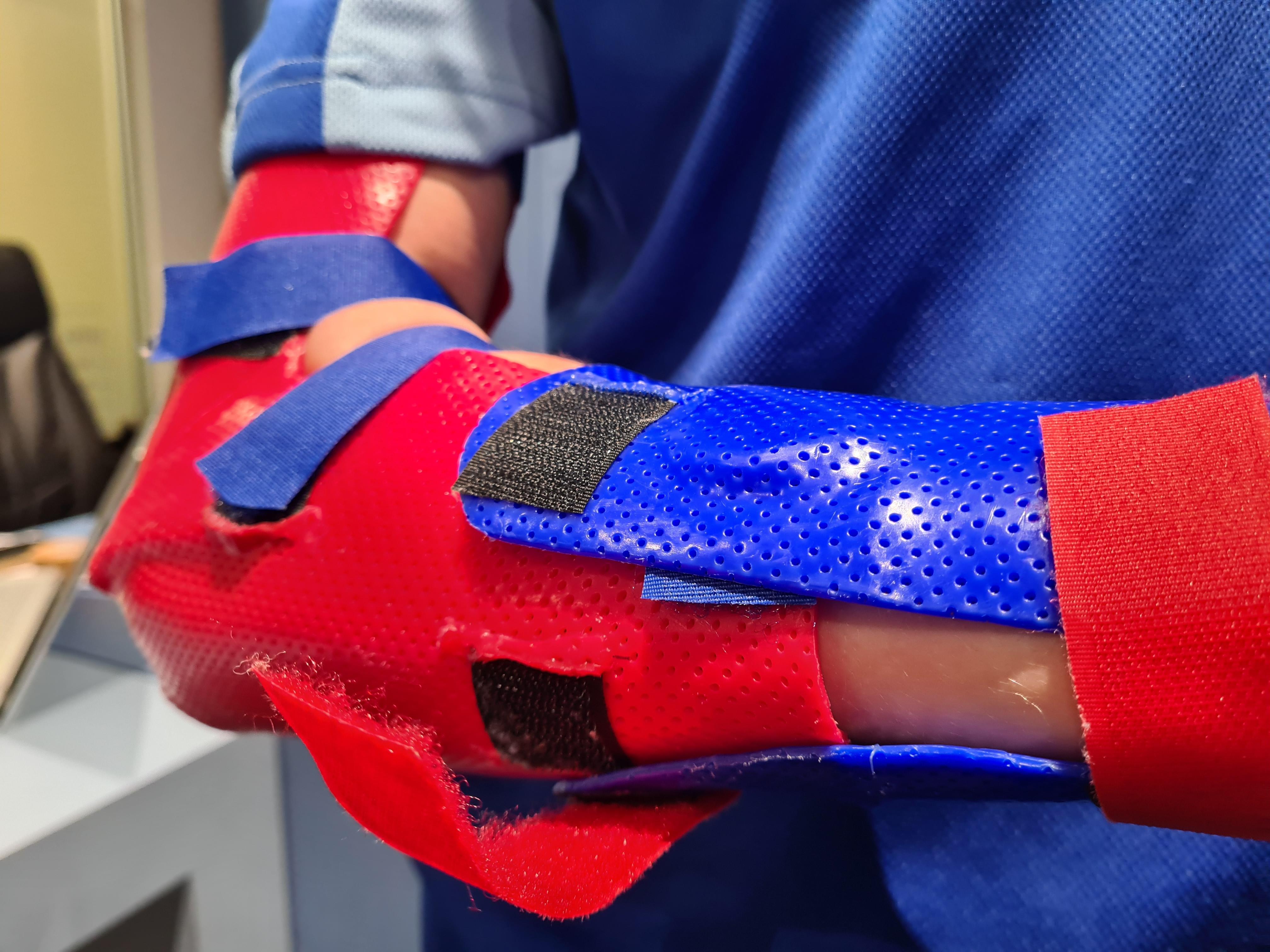 elbow-wrist-splints-2.jpg