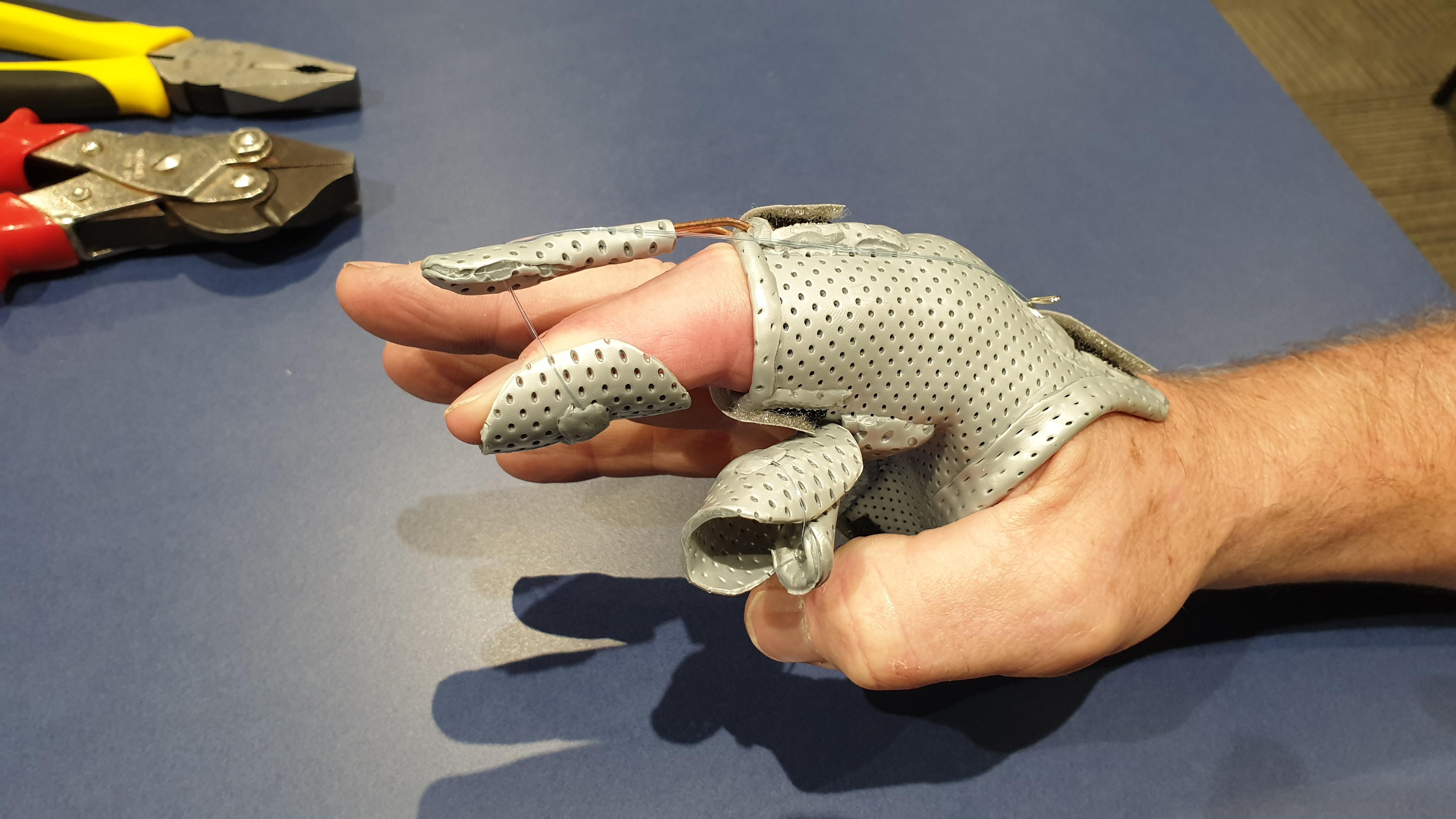 pip-ext-flex-splint-1.jpg